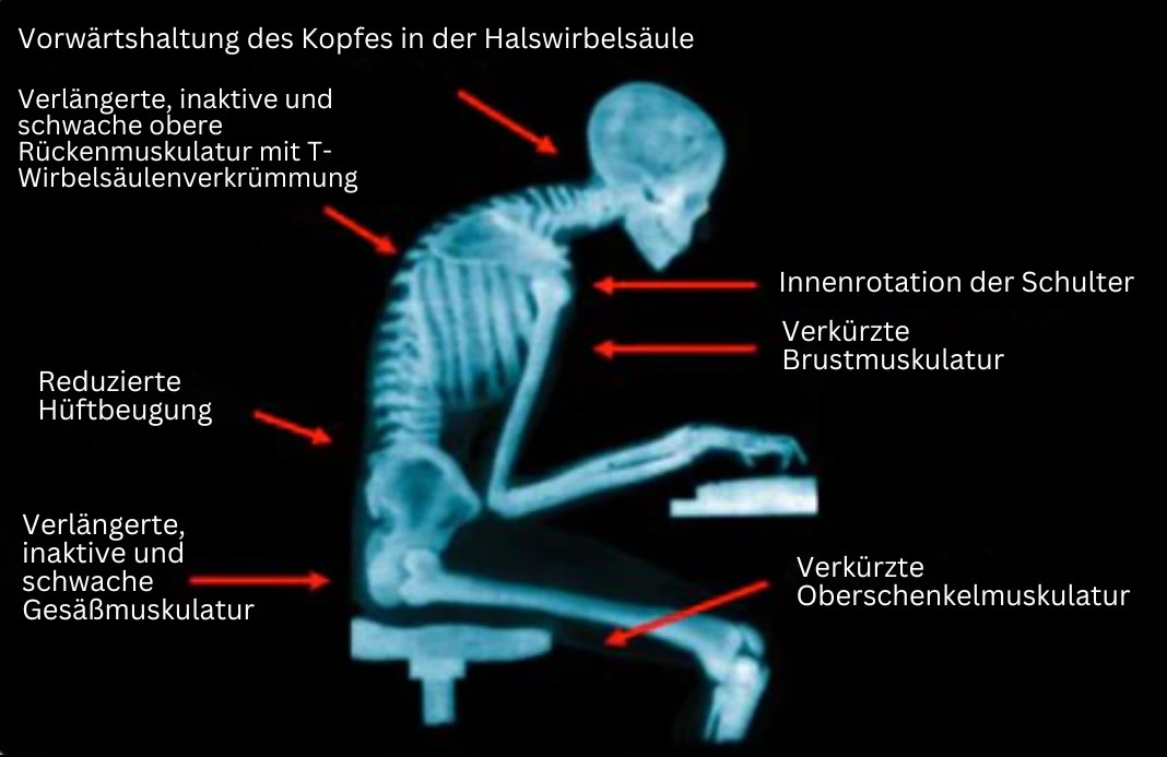 Naisten Asennon Korjaaja Innovatiivisella EMS-teknologialla 3