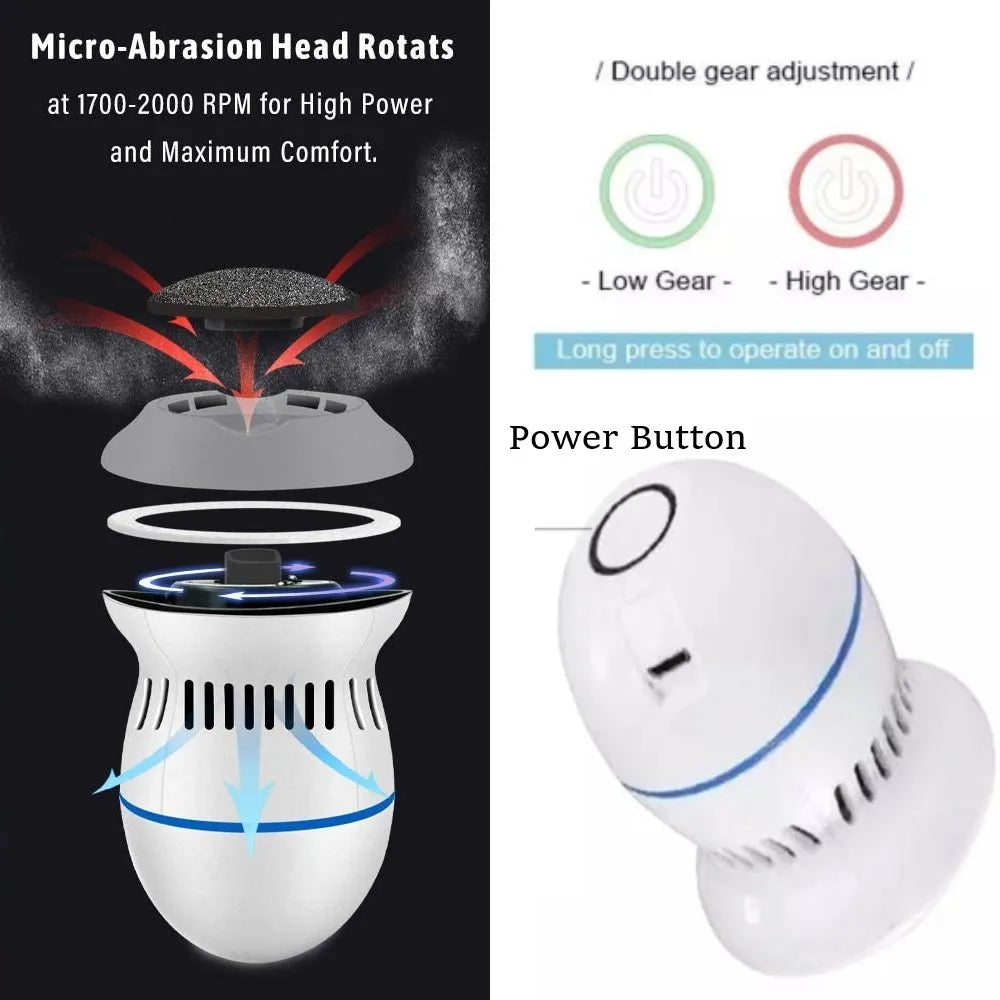 Sähköinen Jalkahiomakone Tehokkaaseen Jalkojenhoitoon 1